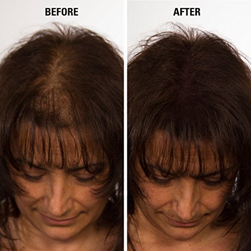 Kadınlar ve Erkekler için Saçları İnceltmek için Eclipse Saç Lifleri (ORTA KAHVERENGİ) - %100 Saptanamayan Lifler - 30g Şişe-15